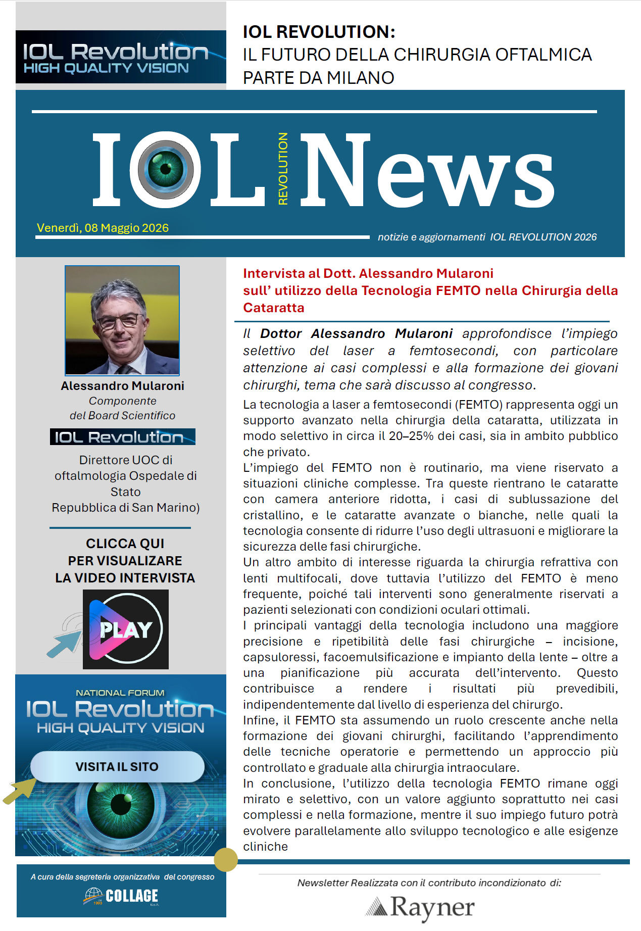 Femtolaser: sì o no negli impianti di IOL multifocali